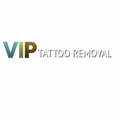VIP Tattoo Removal Las Vegas